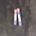 Тринатриев цитрат 0. 4 ML - PINK CAP ЗА E. S. R. , тринатриев цитрат 0. 4 мл в епруветки Ø 13x75 mm