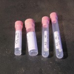 Тринатриев цитрат 0. 25 ML - PINK ОСП - DOUBLE BLOOD LEVEL , тринатриев цитрат 0. 25 мл в епруветки Ø 12x86 mm