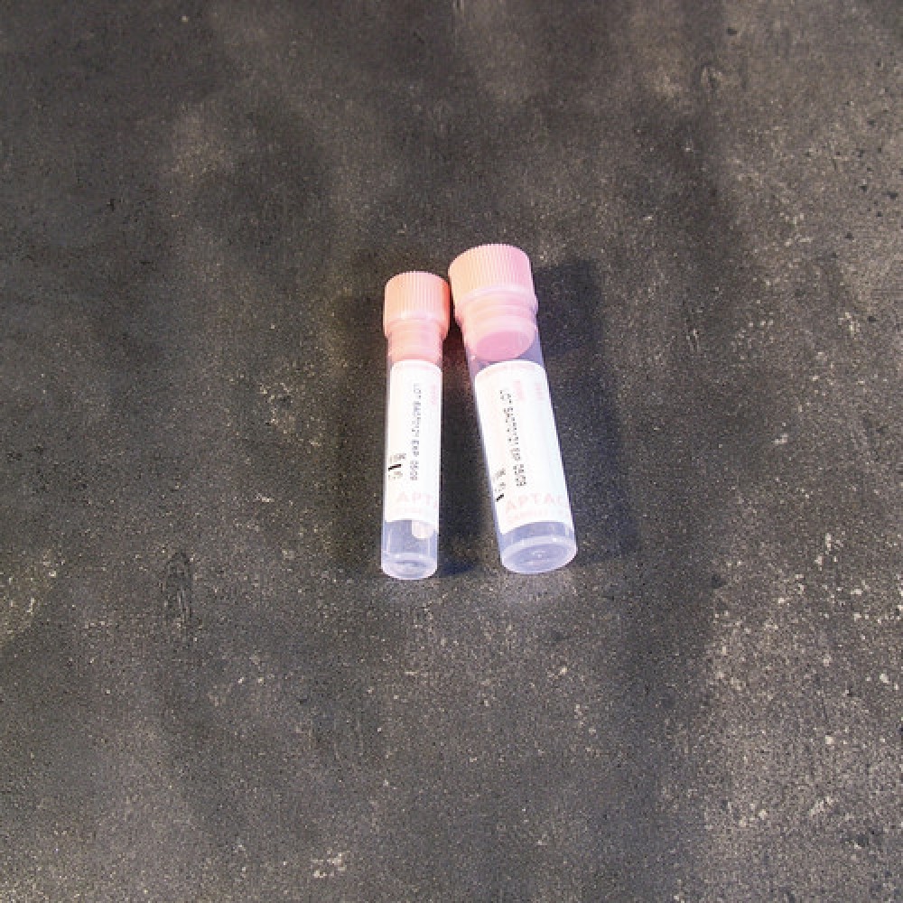 Тринатриев цитрат 0. 25 ML - PINK CAP ЗА E. S. R. , тринатриев цитрат 0. 25 мл в епруветки Ø 12x56 mm