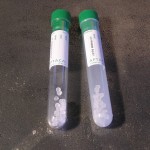 Епруветки с разделящи ГРАНУЛИ GREEN CAP , Vol. 10 мл , Ø 16 х 100 mm , С етикет , PMMA